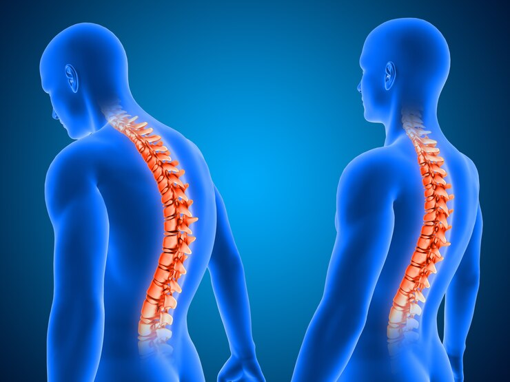 Spine and Nurve Disorders Pain Management at genestac therapeutics
