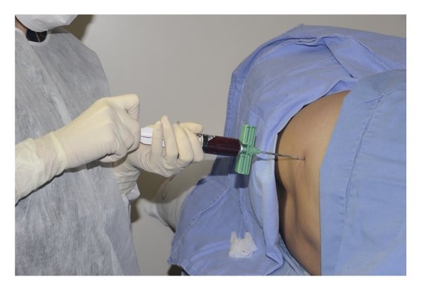 Genestac Therapeutics