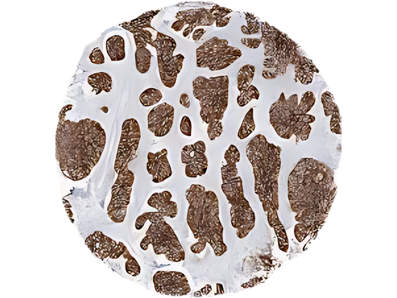 CD 45RA Plasma cells - Genestac Therapeutics