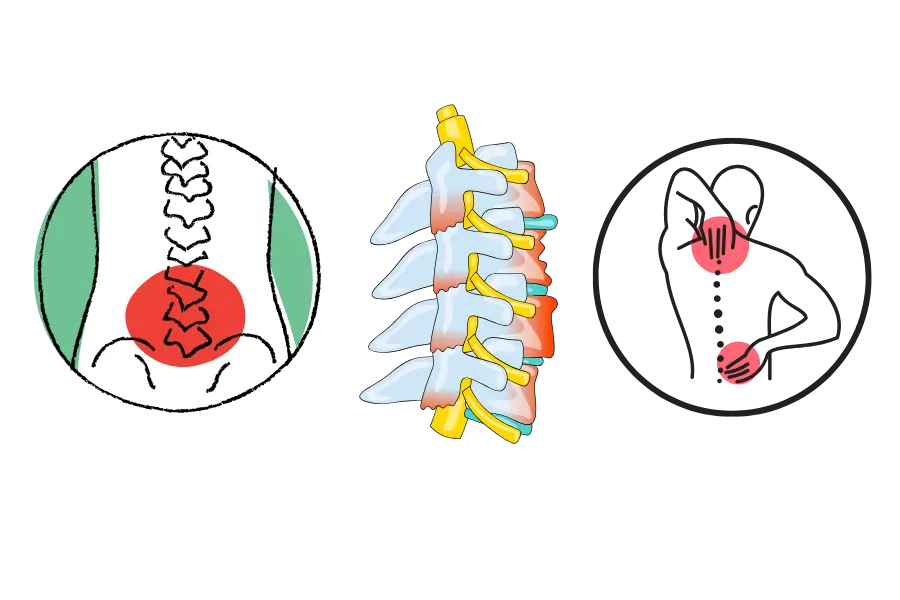 Stem Cell Therapy for Back Pain Treatment - Genestac Therapeutics
